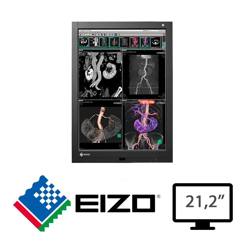 Eizo Regloo Radioforce Gs220 21.2 Medicale.